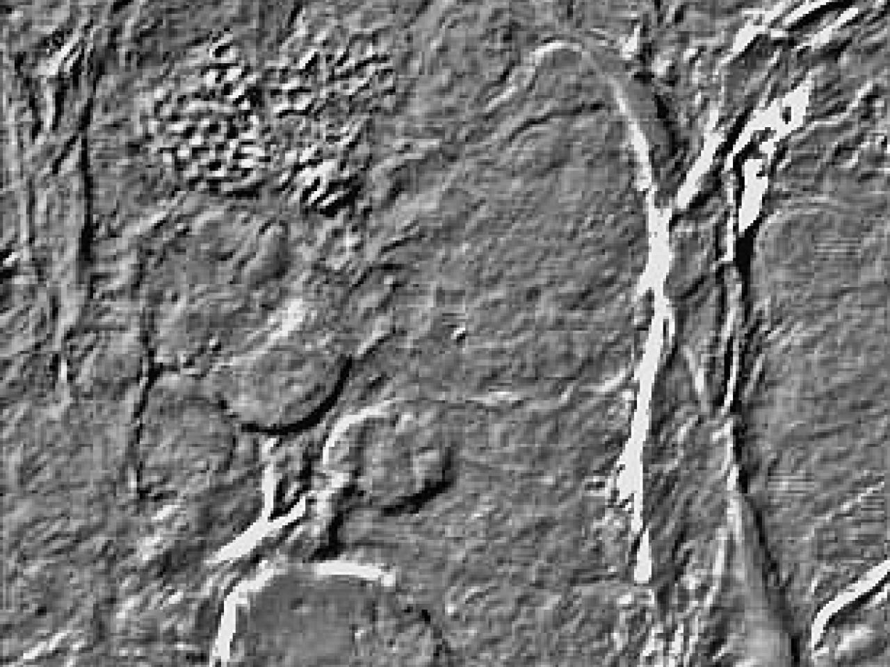 Differential interference contrast (DIC) microscopy image showing cell surface topology and membrane structures in grayscale