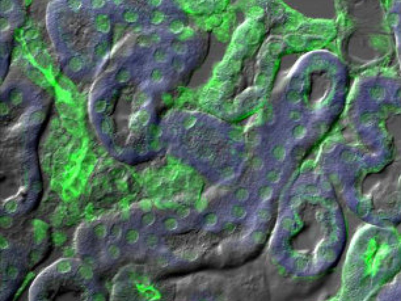 Surface topography image overlaid with fluorescence signal showing tissue structure (grayscale) with specific protein expression or cellular markers (green)