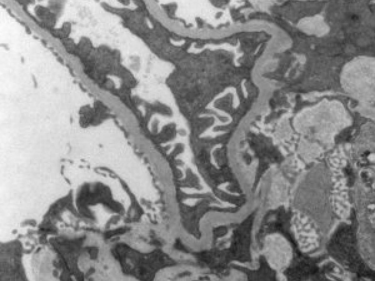A transmission electron microscope (TEM) image showing complex cellular ultrastructure. The image is in black and white with varying shades of gray, revealing intricate membrane structures and organelles. The structures appear branched or folded, with distinct dark and light regions creating a complex pattern. The image shows fine detail of what appears to be either cell membranes or tissue interfaces with various cellular components visible within the structure.