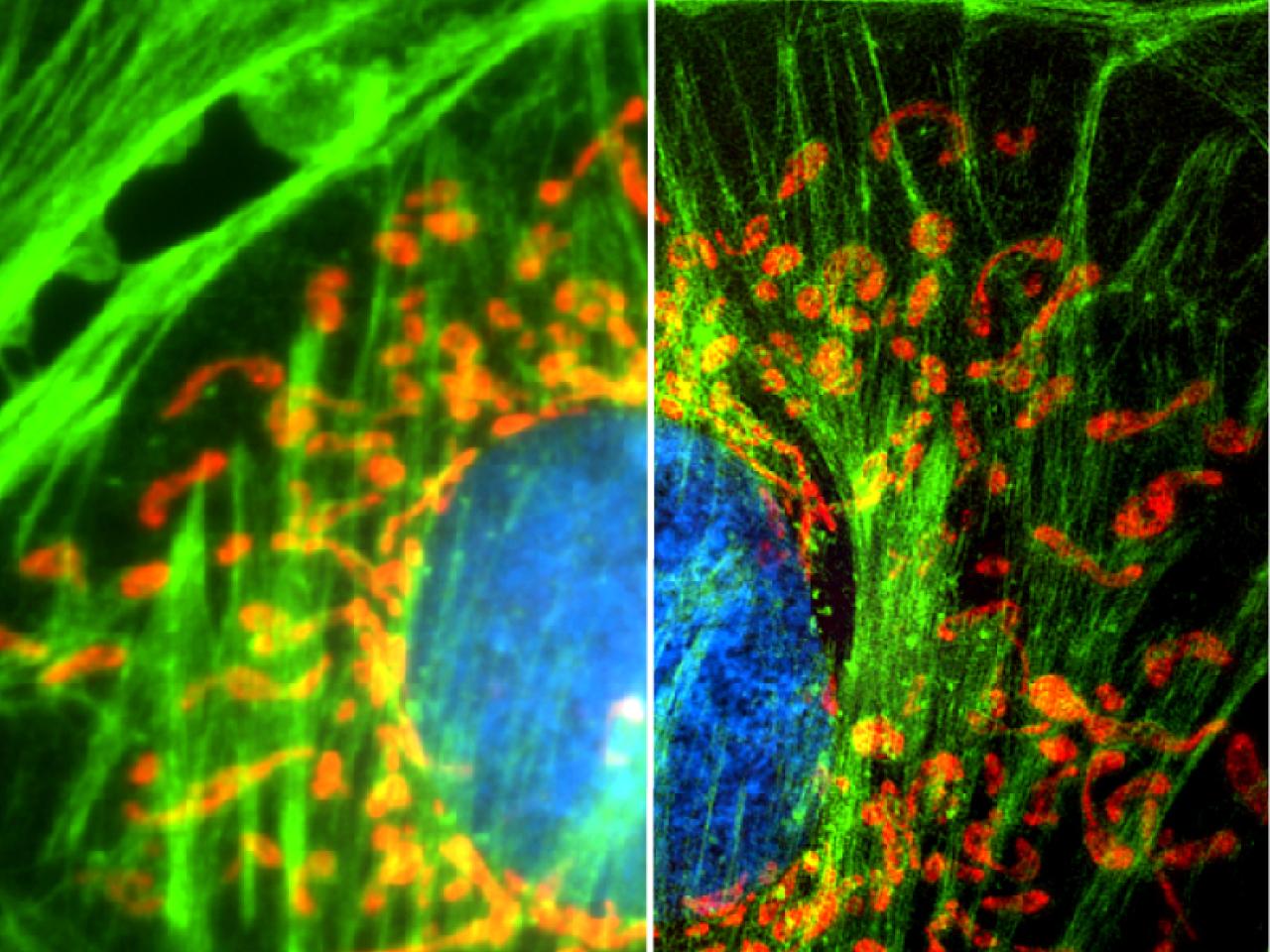 Image of fluorescent cells - comparison of widefield vs structured illumination microscopy