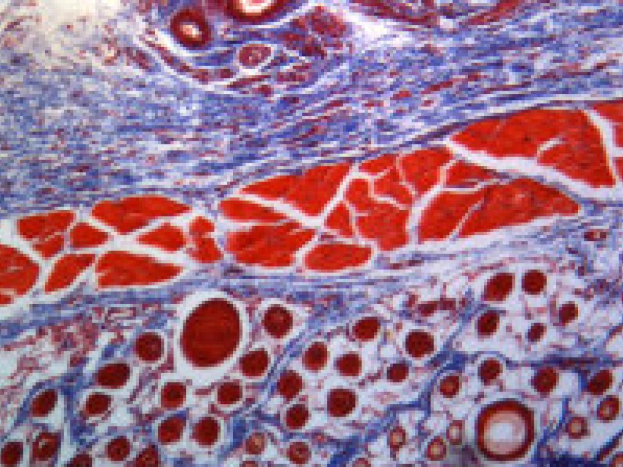 Microscopic image of stained tissue section showing red-stained muscle fibers or blood vessels interspersed with blue/purple connective tissue. The image demonstrates clear tissue architecture and cellular organization typical of histological preparations.
