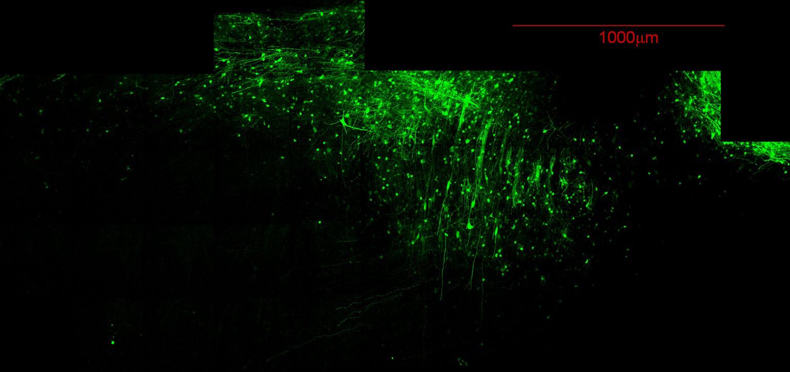 Tiled image stacks of GFP-expressing neurons in an ‘optically cleared’ rat brain section.
