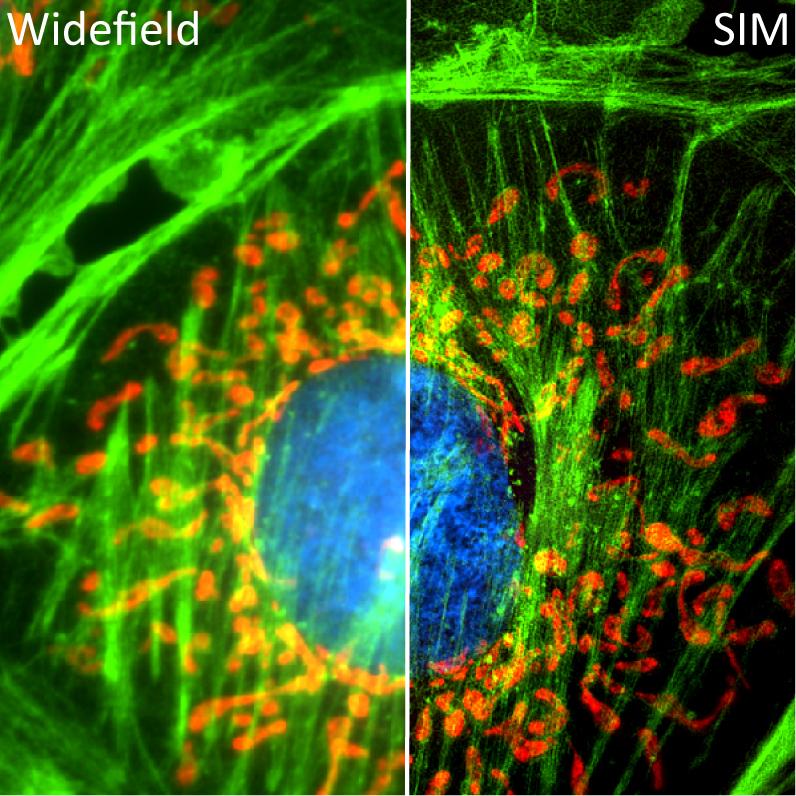 Image of fluorescent cells - comparison of widefield vs structured illumination microscopy