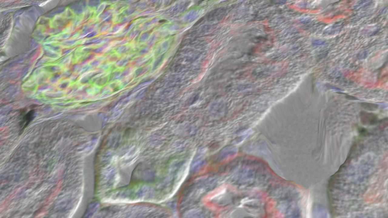 surface DIC displaying fluorescent cells 